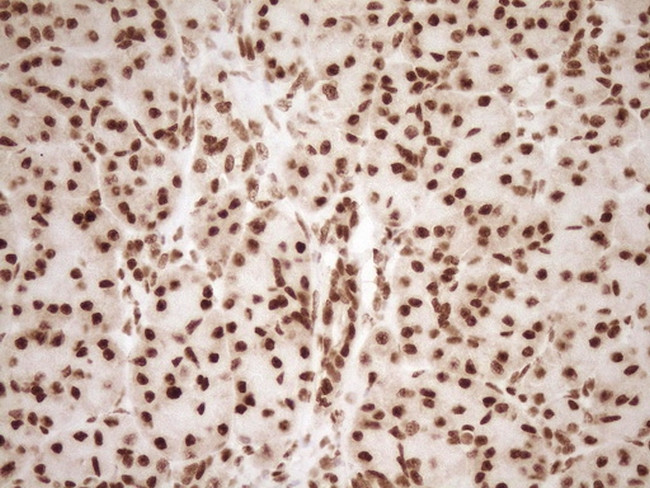 NUDT21 Antibody in Immunohistochemistry (Paraffin) (IHC (P))