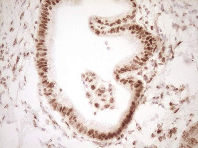 NUDT21 Antibody in Immunohistochemistry (Paraffin) (IHC (P))