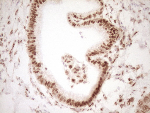 NUDT21 Antibody in Immunohistochemistry (Paraffin) (IHC (P))