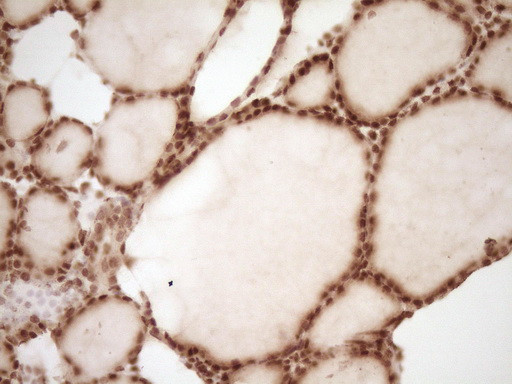 NUDT21 Antibody in Immunohistochemistry (Paraffin) (IHC (P))