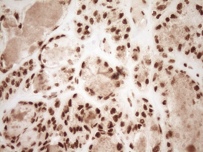 NUDT21 Antibody in Immunohistochemistry (Paraffin) (IHC (P))