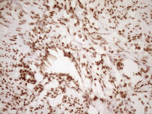 NUDT21 Antibody in Immunohistochemistry (Paraffin) (IHC (P))