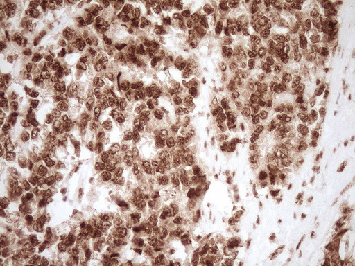 NUDT21 Antibody in Immunohistochemistry (Paraffin) (IHC (P))