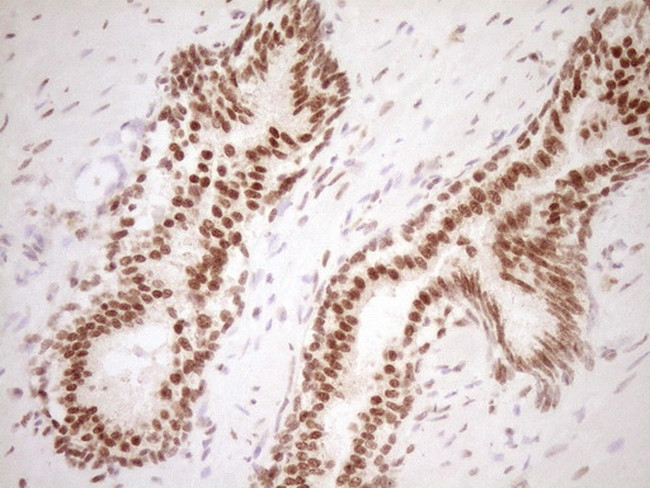 NUDT21 Antibody in Immunohistochemistry (Paraffin) (IHC (P))