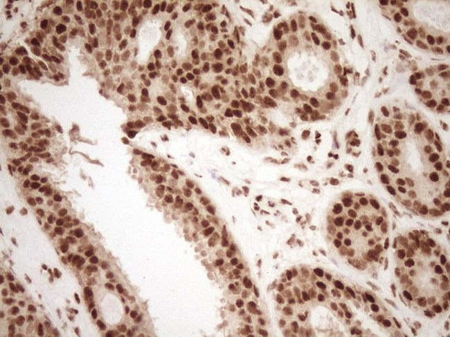 NUDT21 Antibody in Immunohistochemistry (Paraffin) (IHC (P))