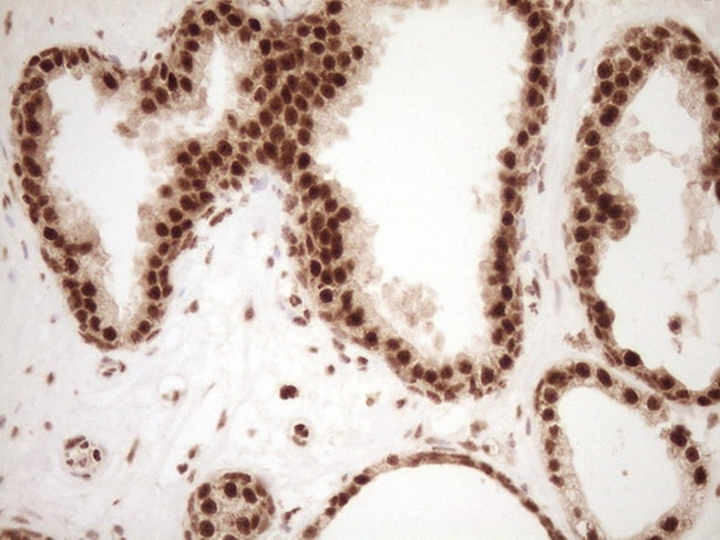 NUDT21 Antibody in Immunohistochemistry (Paraffin) (IHC (P))