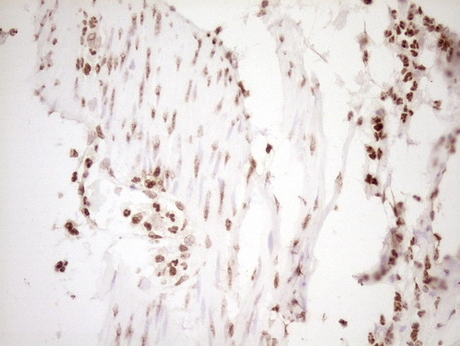 NUDT21 Antibody in Immunohistochemistry (Paraffin) (IHC (P))