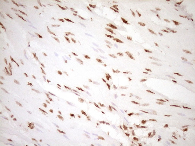 NUDT21 Antibody in Immunohistochemistry (Paraffin) (IHC (P))