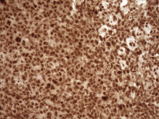 NUDT21 Antibody in Immunohistochemistry (Paraffin) (IHC (P))