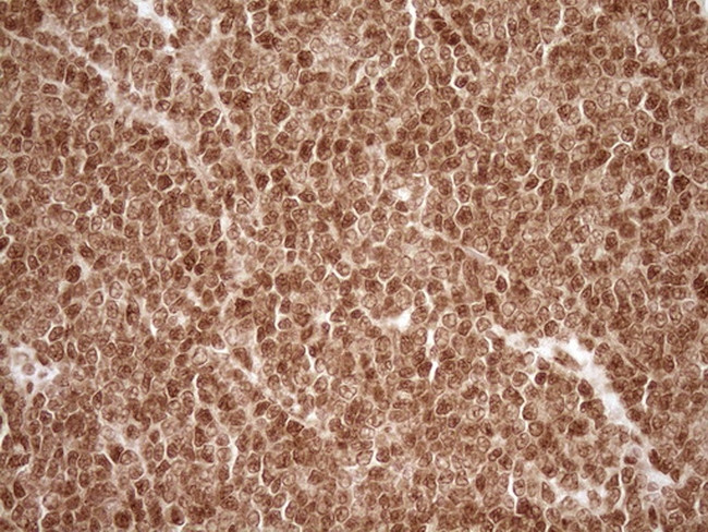 NUDT21 Antibody in Immunohistochemistry (Paraffin) (IHC (P))