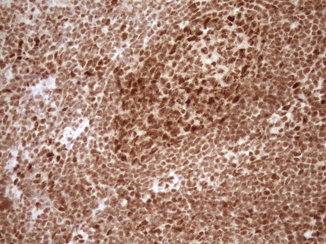 NUDT21 Antibody in Immunohistochemistry (Paraffin) (IHC (P))