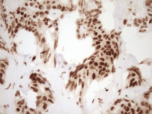 NUDT21 Antibody in Immunohistochemistry (Paraffin) (IHC (P))