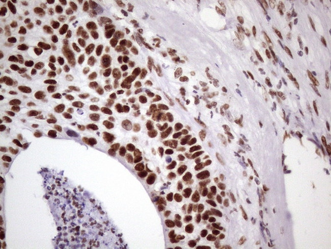 NUDT21 Antibody in Immunohistochemistry (Paraffin) (IHC (P))