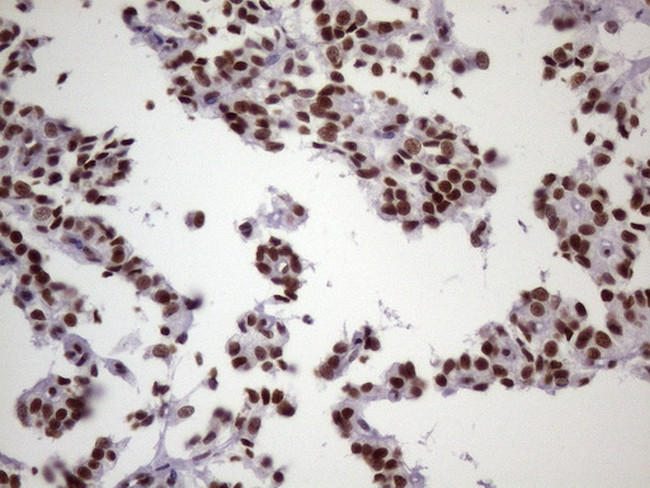 NUDT21 Antibody in Immunohistochemistry (Paraffin) (IHC (P))