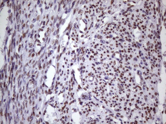 NUDT21 Antibody in Immunohistochemistry (Paraffin) (IHC (P))