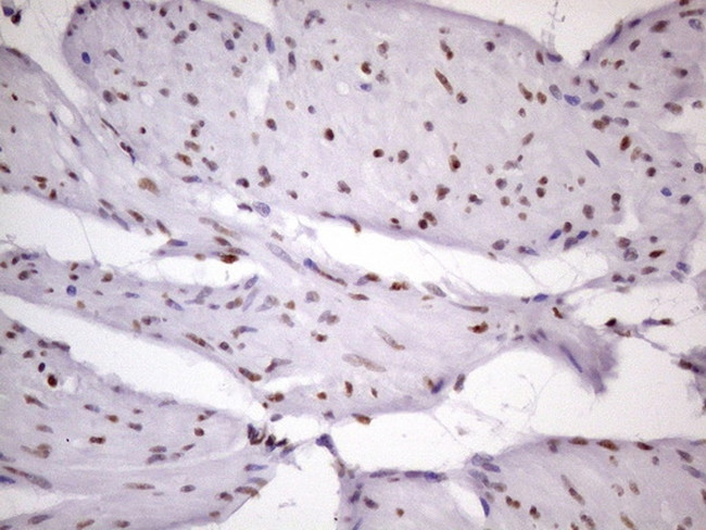 NUDT21 Antibody in Immunohistochemistry (Paraffin) (IHC (P))