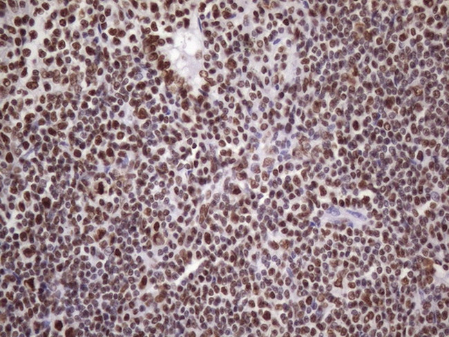 NUDT21 Antibody in Immunohistochemistry (Paraffin) (IHC (P))