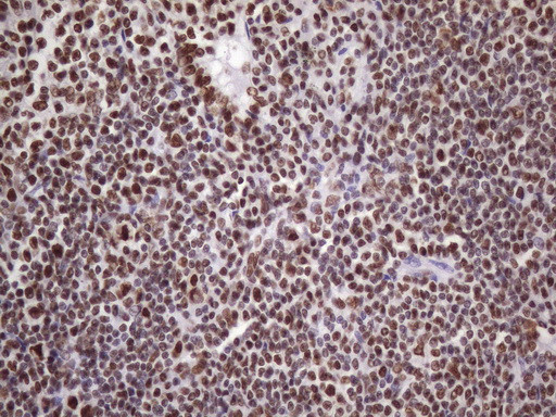 NUDT21 Antibody in Immunohistochemistry (Paraffin) (IHC (P))