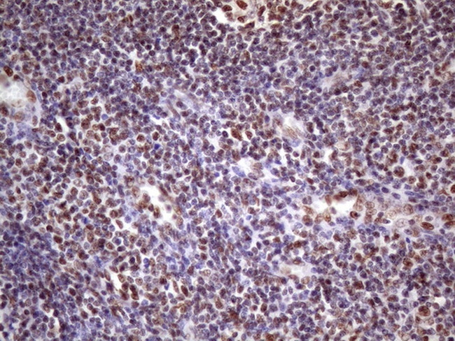 NUDT21 Antibody in Immunohistochemistry (Paraffin) (IHC (P))