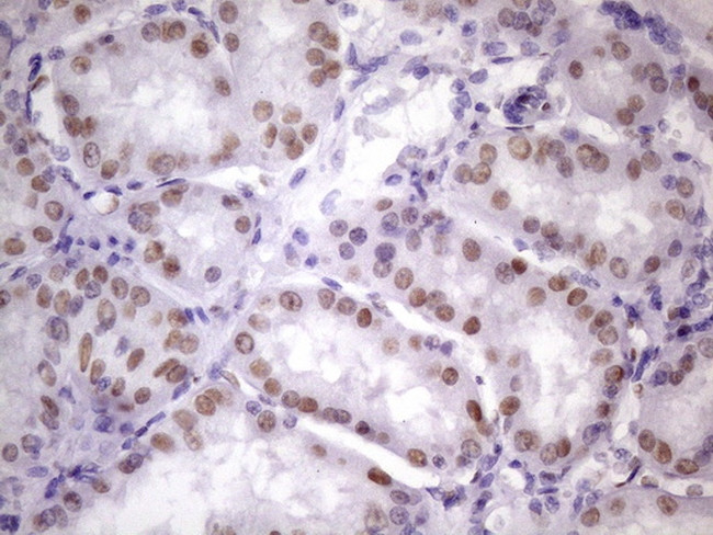 NUDT21 Antibody in Immunohistochemistry (Paraffin) (IHC (P))