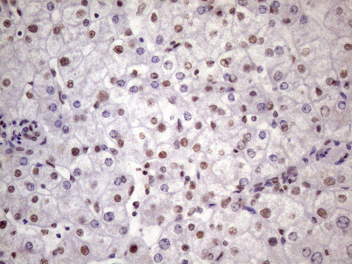 NUDT21 Antibody in Immunohistochemistry (Paraffin) (IHC (P))