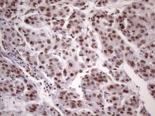 NUDT21 Antibody in Immunohistochemistry (Paraffin) (IHC (P))