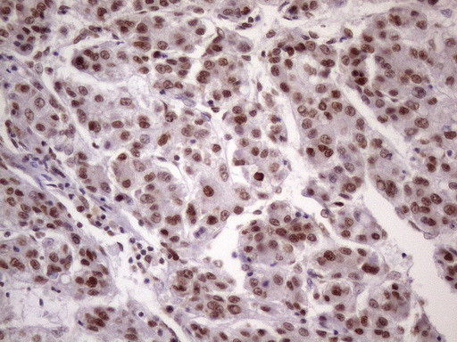 NUDT21 Antibody in Immunohistochemistry (Paraffin) (IHC (P))