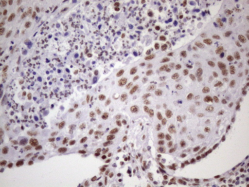 NUDT21 Antibody in Immunohistochemistry (Paraffin) (IHC (P))