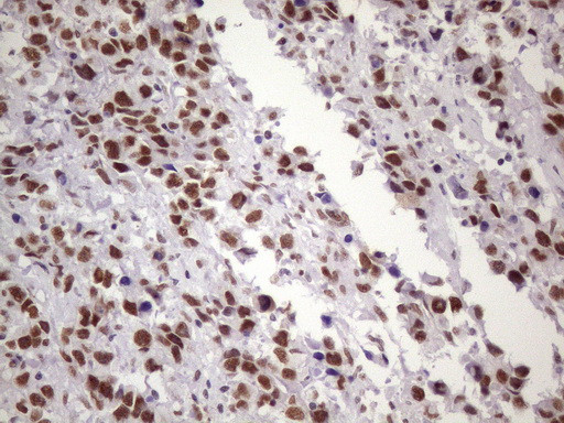 NUDT21 Antibody in Immunohistochemistry (Paraffin) (IHC (P))