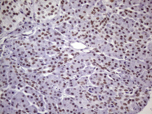 NUDT21 Antibody in Immunohistochemistry (Paraffin) (IHC (P))