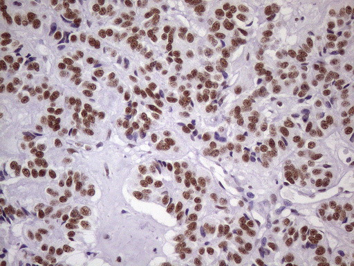 NUDT21 Antibody in Immunohistochemistry (Paraffin) (IHC (P))