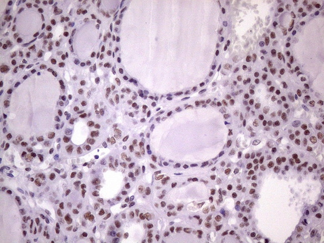 NUDT21 Antibody in Immunohistochemistry (Paraffin) (IHC (P))