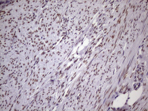 NUDT21 Antibody in Immunohistochemistry (Paraffin) (IHC (P))