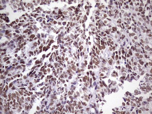 NUDT21 Antibody in Immunohistochemistry (Paraffin) (IHC (P))