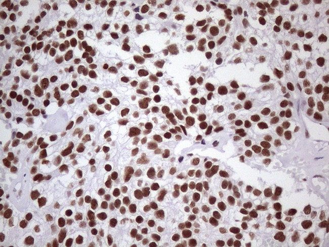 NUDT21 Antibody in Immunohistochemistry (Paraffin) (IHC (P))