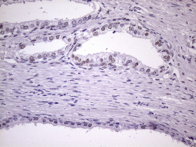 NUDT21 Antibody in Immunohistochemistry (Paraffin) (IHC (P))