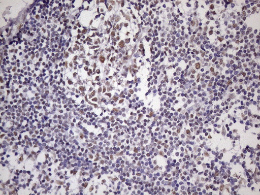 NUDT21 Antibody in Immunohistochemistry (Paraffin) (IHC (P))