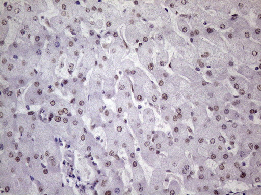 NUDT21 Antibody in Immunohistochemistry (Paraffin) (IHC (P))