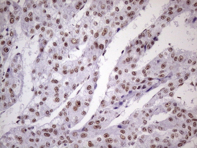 NUDT21 Antibody in Immunohistochemistry (Paraffin) (IHC (P))