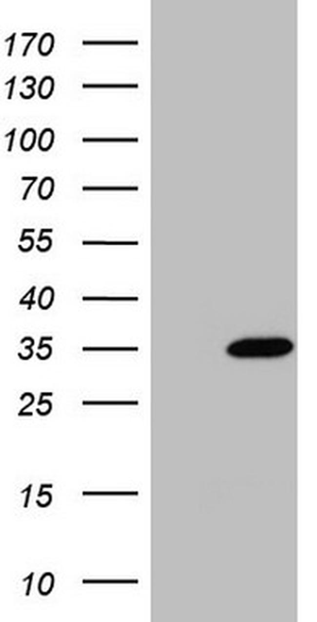 NUDT21 Antibody in Western Blot (WB)