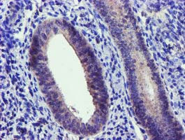 NUDT6 Antibody in Immunohistochemistry (Paraffin) (IHC (P))