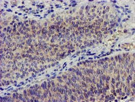 NUDT6 Antibody in Immunohistochemistry (Paraffin) (IHC (P))