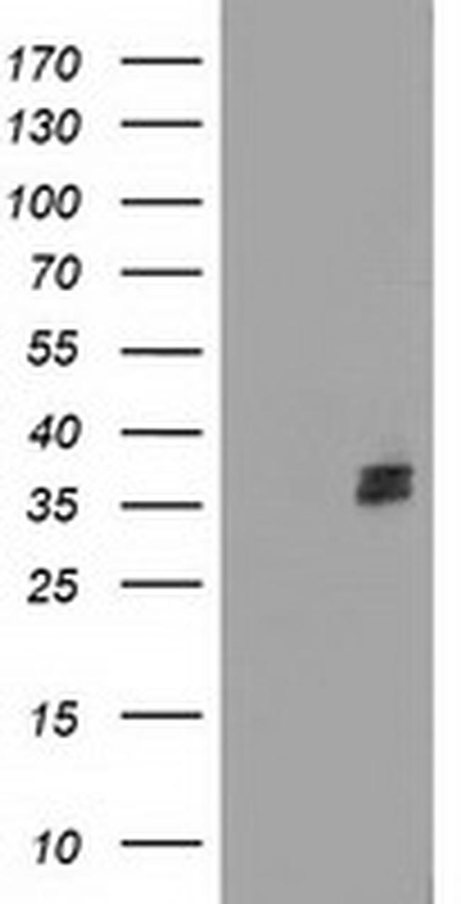 NUDT6 Antibody in Western Blot (WB)