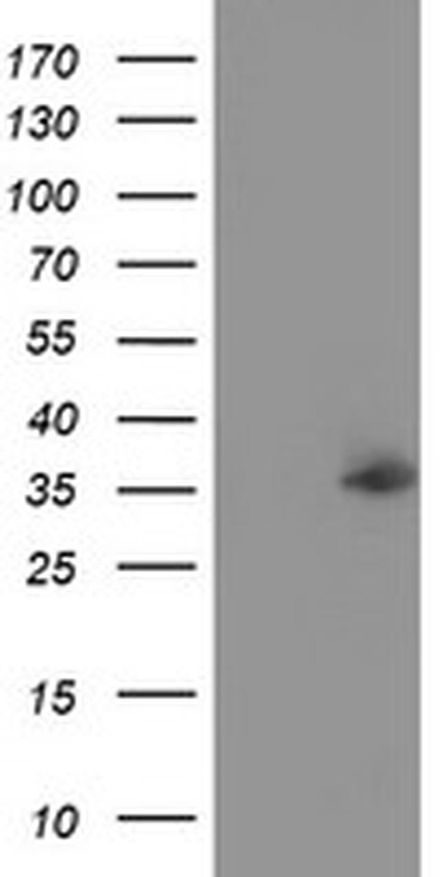 NUDT6 Antibody in Western Blot (WB)