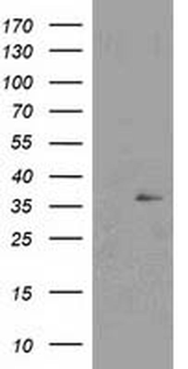 NUDT6 Antibody in Western Blot (WB)