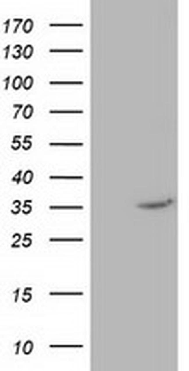 NUDT6 Antibody in Western Blot (WB)