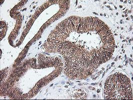 NUDT9 Antibody in Immunohistochemistry (Paraffin) (IHC (P))