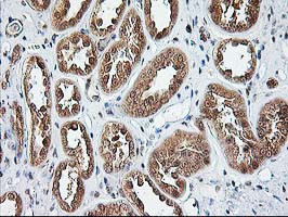 NUDT9 Antibody in Immunohistochemistry (Paraffin) (IHC (P))