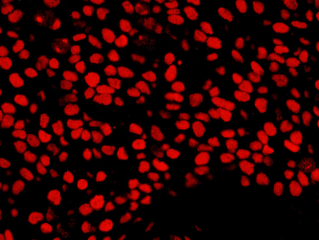 NUMA Antibody in Immunohistochemistry (Paraffin) (IHC (P))