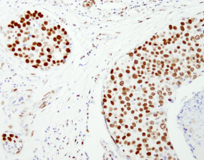 NUMA Antibody in Immunohistochemistry (IHC)